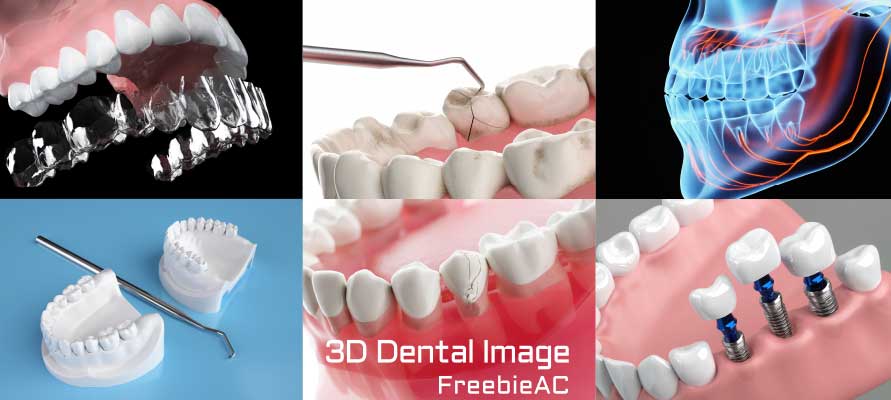 3D 치과 이미지