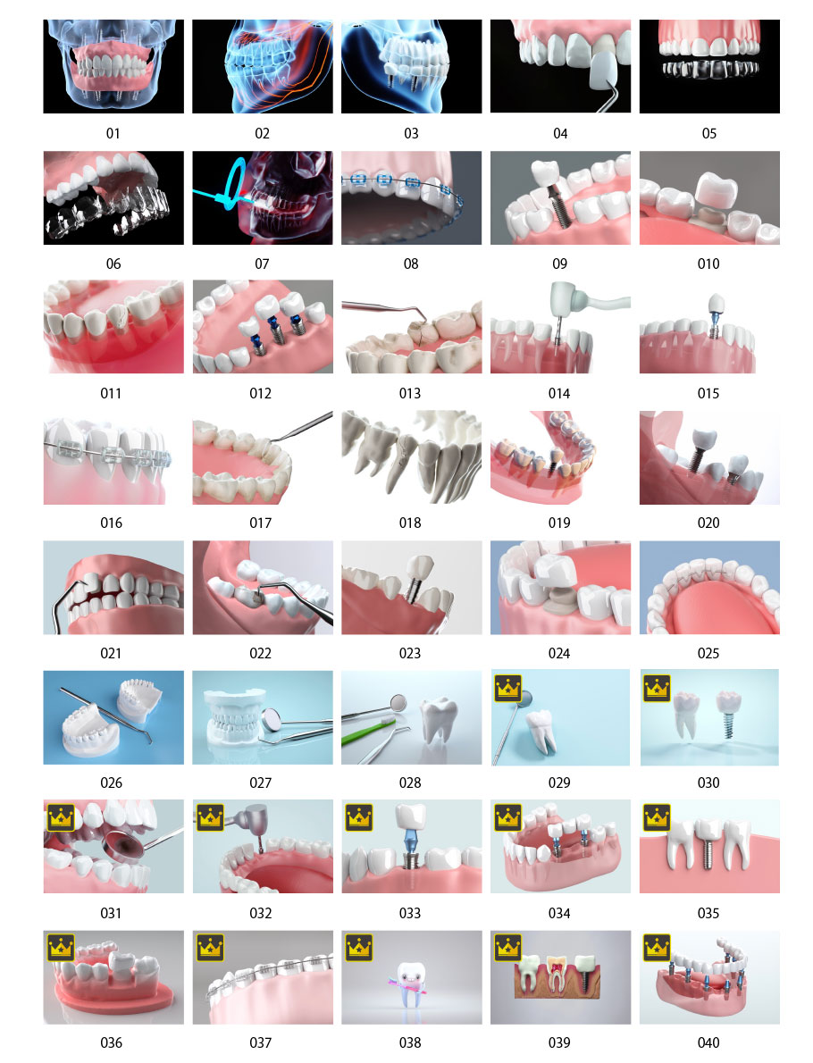 3D dental images